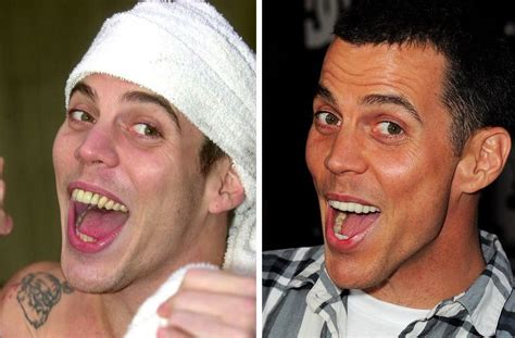 celebrity teeth six best dental before and after makeovers celebrity teeth celebrities with