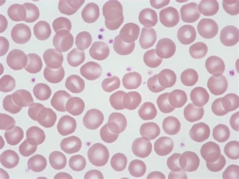 Die blutplättchen können sich über offene wunden legen, indem sie sich an die gefäßwände heften und mit anderen thrombozyten zu einer art pfropfen verbinden. Detailansicht - Sysmex Deutschland GmbH