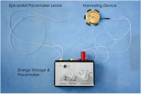 Battery Less Pacemaker Works Like An Automatic Wristwatch Powered By