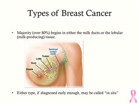 Most types of breast cancers are adenocarcinomas of the breast. PPT - Breast Cancer An Overview PowerPoint Presentation ...