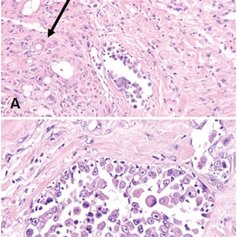 Primary Canine Inflammatory Mammary Carcinoma Origin Of The Cell Line