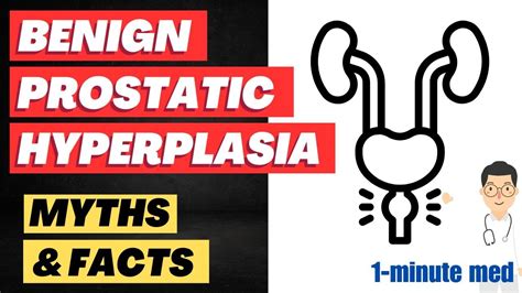 Bph Benign Prostatic Hyperplasia Myths Busting Youtube