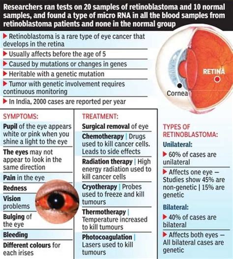 Blood Test To Help Detect Eye Cancer In Children India News Times