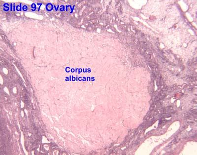 Corpus Albicans Wikiwand