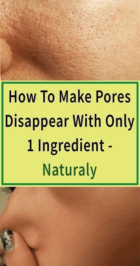 How To Make Pores Disappear With Only 1 Ingredient Naturally Skin