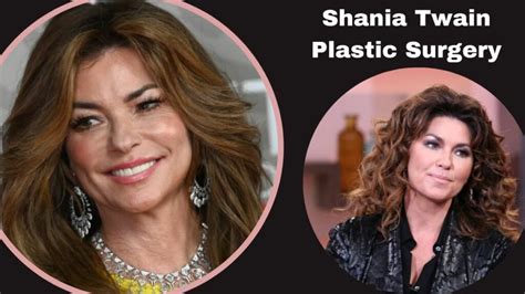 shania twain plastic surgery was country pop s queen cut too close