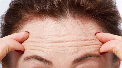 How To Reduce Forehead Wrinkles Easily And Without Leaving Home Koko