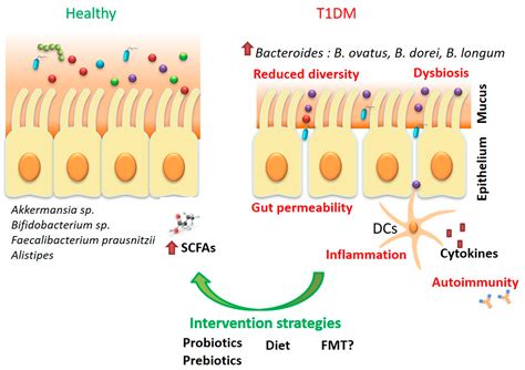 Ijms Free Full Text Dysbiosis In The Development Of Type I Diabetes