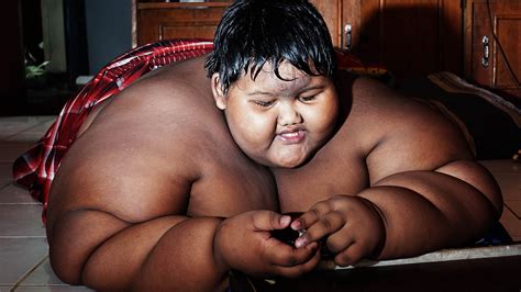 El niño más gordo del mundo perdió 182 libras y ahora luce