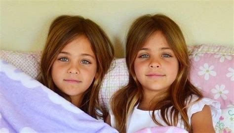 These Twins Were Named “most Beautiful In The World” Wait Till You See