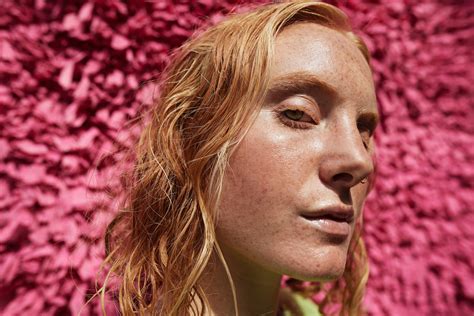 7 Ways To Get Freckles In The Sun Without Putting Yourself At Risk