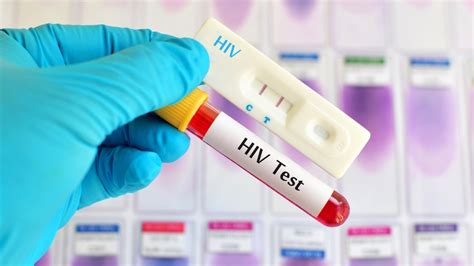 Banyak Ibu Rumah Tangga Yang Kena Begini Tahapan Tes Dan Pengobatan HIV Yang Ditanggung BPJS
