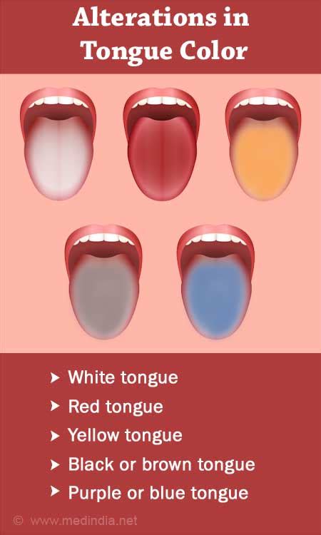 Normal Healthy Tongue Color