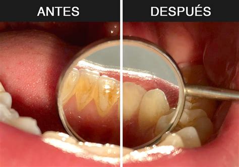 Simple Science: How to Make a Volcano with Kids