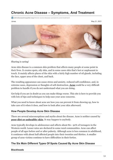 Ppt Chronic Acne Disease Symptoms And