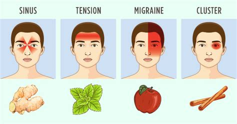 This article exposes home remedies for migraines that work for kids and adults so you can get a natural relief from migraine. At home remedies for migraines - Philadelphia Holistic Clinic