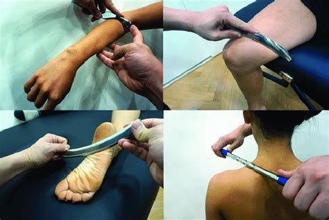 application of instrument assisted soft tissue mobilization using download scientific diagram
