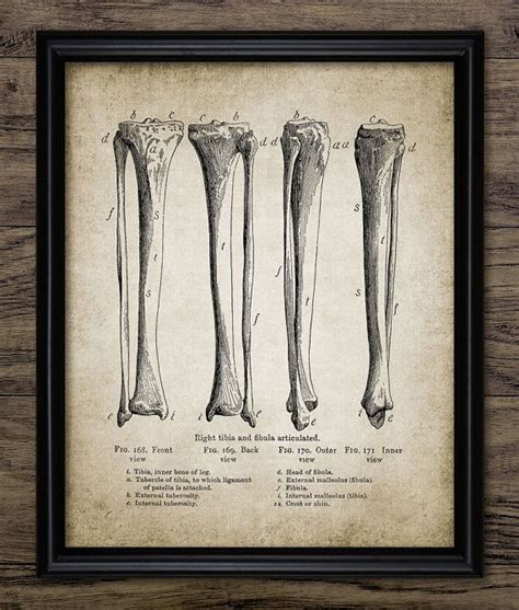 Three Different Types Of Bones Are Shown In This Framed Art Print