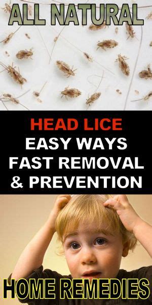 How To Prevent Head Lice Best And Also Fastest All Natural Remedies To