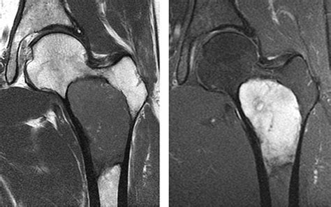 Which bones form the pelvis? Information about Peace Regional MRI clinic in Dawson Creek