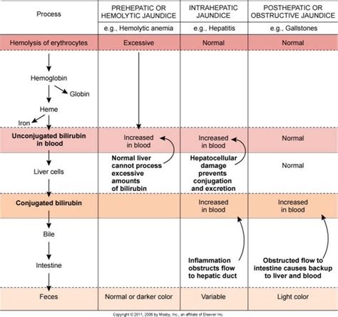 Jaundice Prehepatic Intrahepatic And Posthepatic Diagram Quizlet