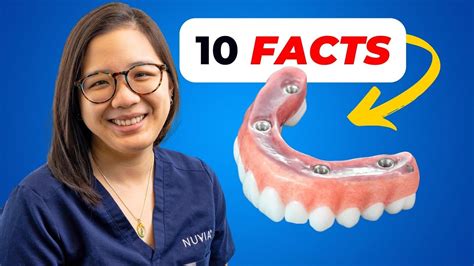 10 Facts About All On 4 Dental Implants You Need To Know Dental Clinic