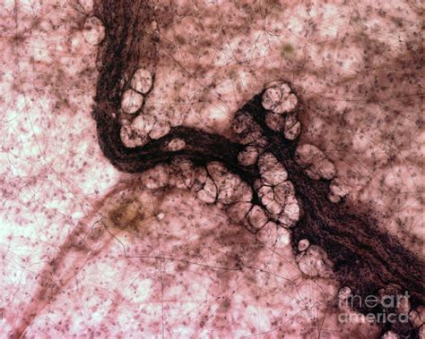 Areolar Loose Connective Tissue Photograph By Ikelos Gmbh Dr