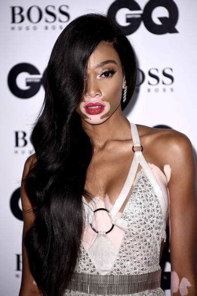 Winnie Harlow Hair Best Celebrity Hairstyles And Beauty 2017 Glamour Uk
