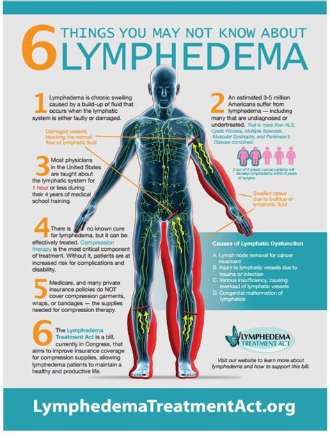 Facts About The Puff Lymphedema Treatment Lymphedema Awareness