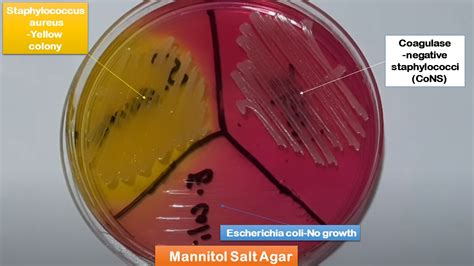 Mannitol Salt Agar Uninoculated