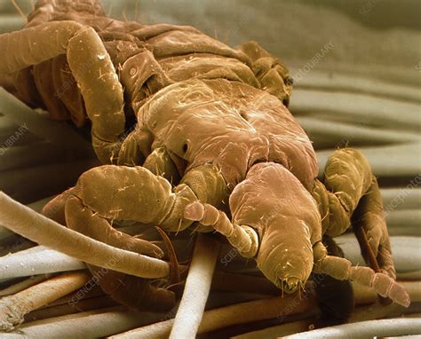 Sem Of A Human Head Louse On Hair Shafts Stock Image Z2650104