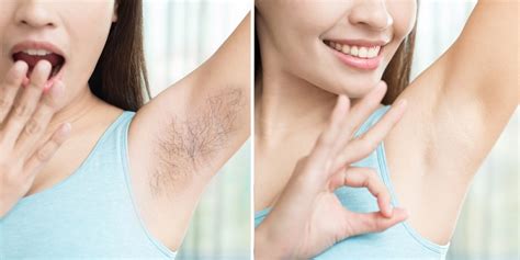 7 Ways To Stop Excessive Sweating In Armpits
