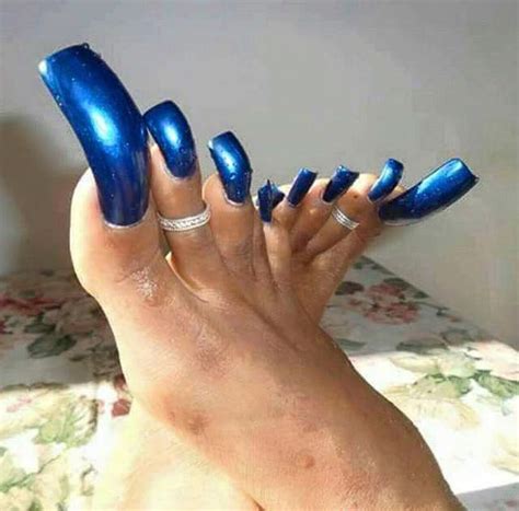 Crazy Toenails You Wont Be Able To Unsee 10 Photos Long Toenails