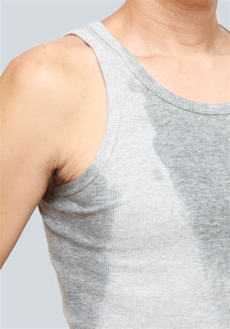 Excessive Sweating The Laser And Skin Clinic