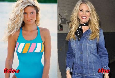 Christie Brinkley Plastic Surgery What Do You Think