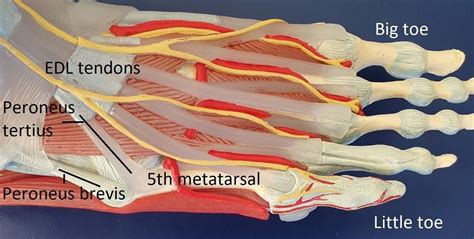 5th Metatarsal Fracture Dr Ben Beamond Adelaide