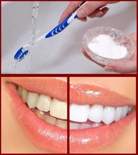 How To Whiten Teeth At Home With Baking Soda