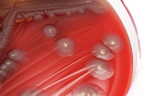 Escherichia Coli Bacterial Culture Photograph By Daniela Beckmann Science Photo Library Pixels