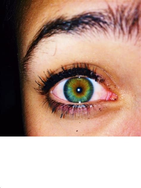 Central Heterochromia Heterochromia Eyes Eye Pattern Aesthetic