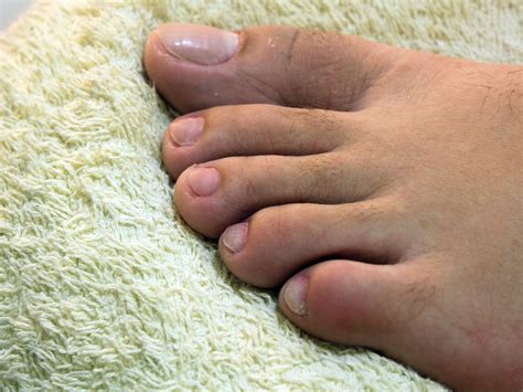 Keeping your feet moisturized will keep the skin soft and supple. How to Keep Your Feet and Toenails Healthy: 10 Steps