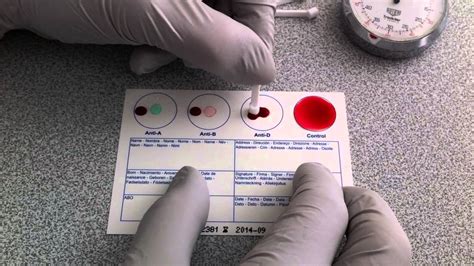 Learn about the different types of blood tests and what they mean here. Blood Typing Using EldonCard (HD) - YouTube