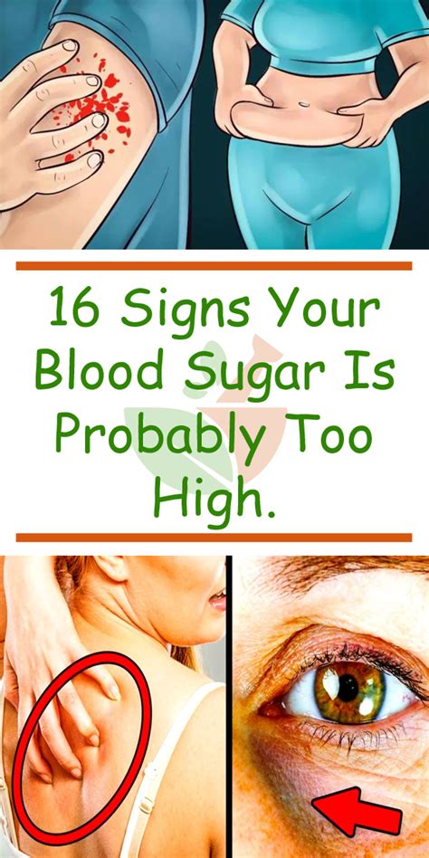 Important 16 Signs Your Blood Sugar Is Too High Low Blood Sugar