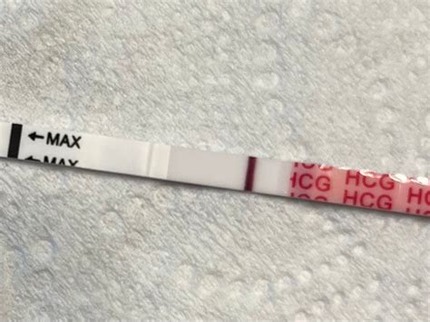 Pregmate Indent