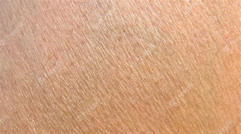 Human Skin Texture Photo Premium Download