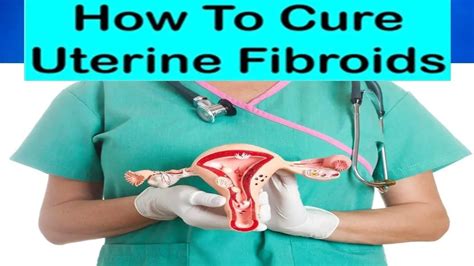 Fibroids Symptoms And Home Remedies To Naturally Treat Fibroids At Home