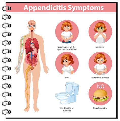 Appendicitis Symptoms Infographic Stock Vector Illust