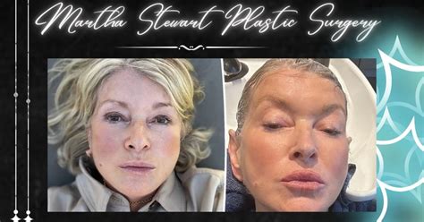 Martha Stewart Plastic Surgery News Just Fake Rumors Or Reality