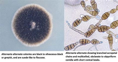 Alternaria Alternata An Overview