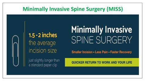 Ppt Minimally Invasive Spine Surgery Miss Powerpoint Presentation