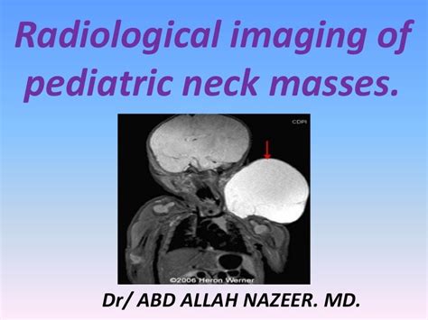 Presentation1pptx Radiological Imaging Of Pediatric Neck Masses